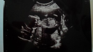 Baby Garth at 16 weeks... Yes, I am now that person who finds the ultrasound picture truly fascinating, even though it looks like so many other ultrasound pictures I've seen!